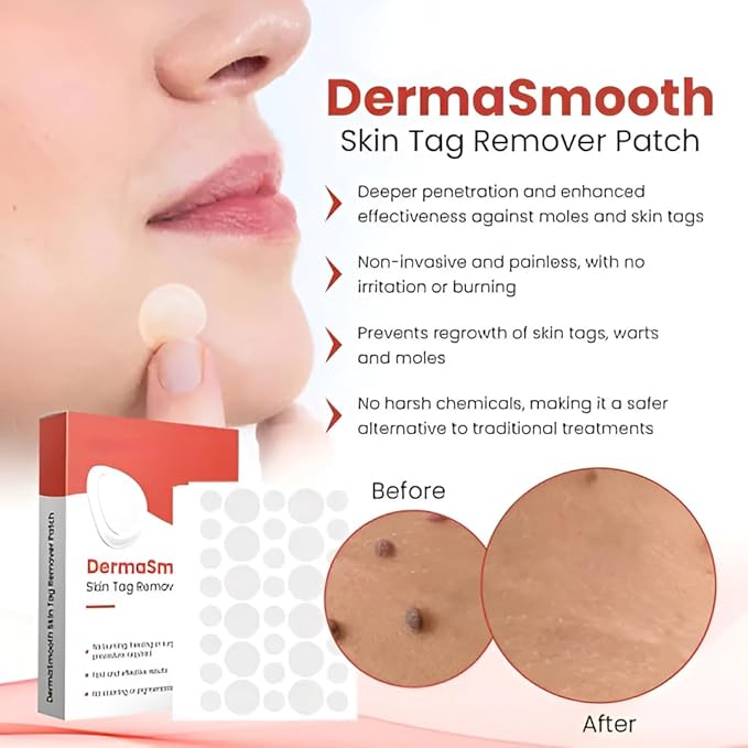 Derma Smooth Skin Tag Removal Patch – Painless, Natural Formula